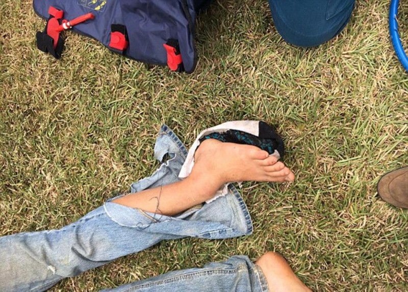 iphone-headphones-slice-teen-neck-motorbike-crash1