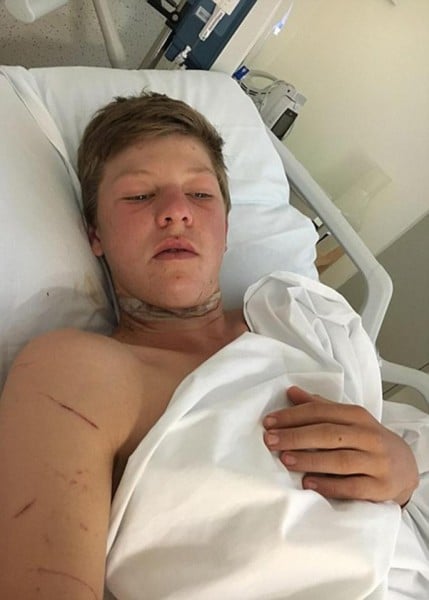 iphone-headphones-slice-teen-neck-motorbike-crash2