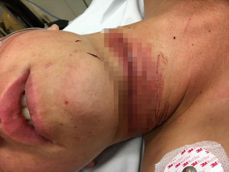 iphone-headphones-slice-teen-neck-motorbike-crash3